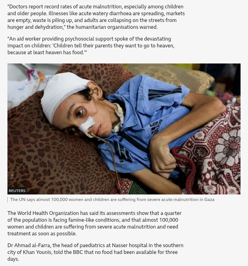 Picture of a child emaciated dying of starvation malnutrition nobody is liberating them in 2025