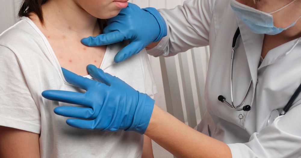 4 ways vaccine skeptics mislead you on measles and more