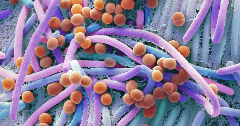 La biodiversité microbienne à l’épreuve de l’action humaine