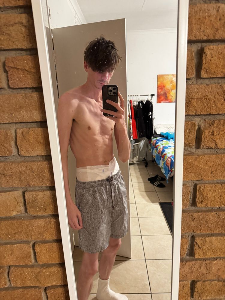 Diaper under shorts