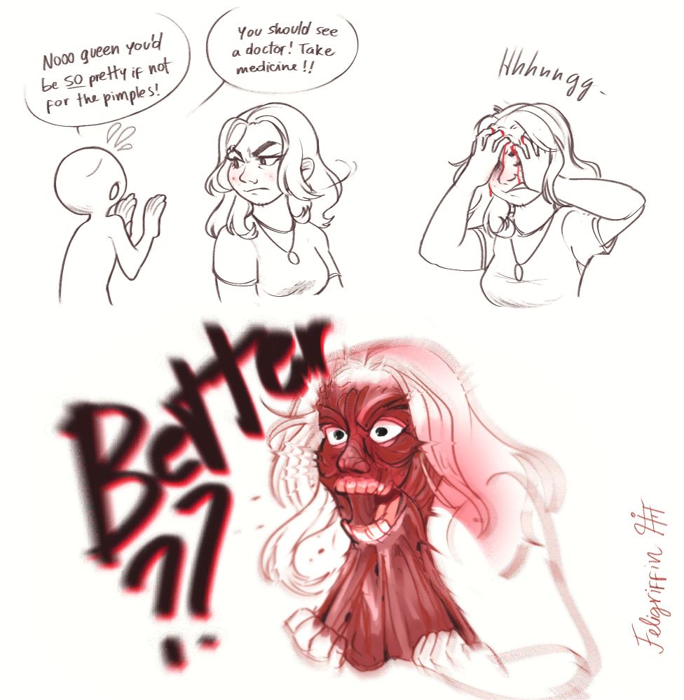 In my teens, I used to struggle with pimples and whatnot, and tend to break out near my period. I have a healthy diet and good hygiene, so I thought it was just hormones and that it would go away once I grew up.

Except it never did, lol. I'm an adult in my late 20s and still gotta deal with this bullshit.

It's never bothered me half as much as everyone else around me. The words paraphrase something I heard from a stranger a long time ago, who 'just wanted to help'. I understand there was no ill intent, but I think about it sometimes.

Good intent is sweet, but it can also harm. Sometimes it's best to just respect people and leave them alone. Zits dry out and eventually leave the skin; it's part of the process. There are times it'll be nice and others when they'll come back; it's never been a health concern as much as an aesthetic issue.

It feels especially backhanded when paired with "you're so pretty BUT".

Most fancy skincare products cost an arm and a leg for a small tube. There's a big market monetizing people's insecurities, and the feeling of depending on these things has always irked me. I went to the dermatologist some time ago after being pestered about it for a long time, since I wanted to give it an honest shot.

It was expensive, and although it did help, the difference wasn't worth the money spent imo. My skin still has imperfections.

Having a skincare routine is good, I've had it even before that. Soap 
 to reduce natural oils is good, and a white clay mask is nice and cheap; it feels nice. Better than selling my organs for skin products, lol.

Embracing staying healthy, imperfect and not-broke has been very good for me. Taking care of yourself is good, but don't let beauty standards dictate your life. Those who turn their noses from your packaging alone could never understand the essence of what lies within, so you're not missing out ❤️