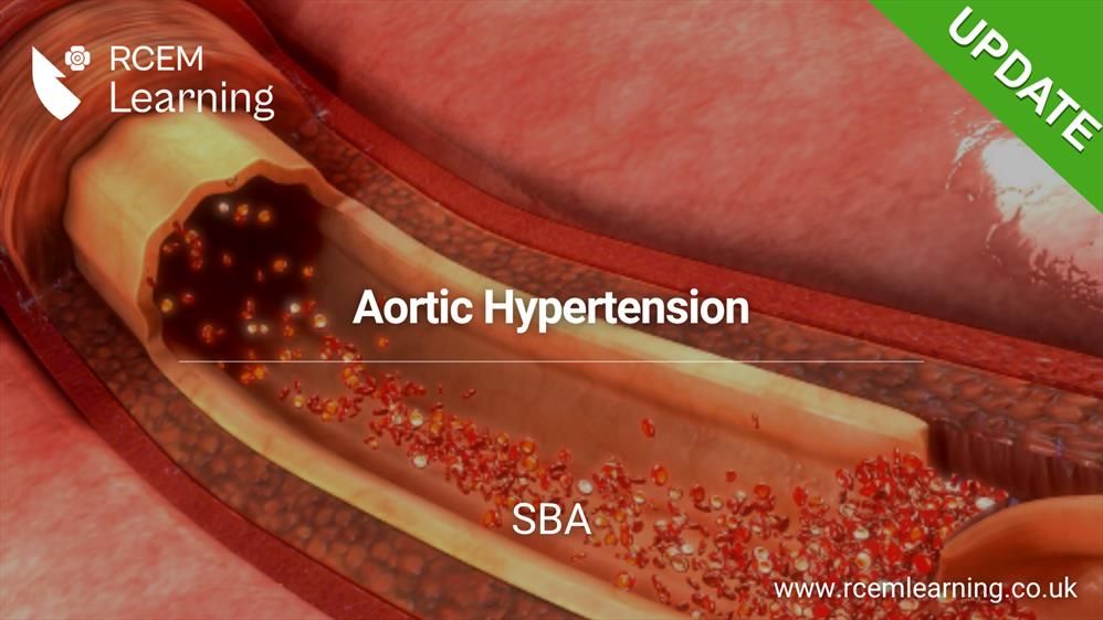 RCEMLearning logo in white. An animated picture of Aortic Hypertension. Alt Text: Aortic Hypertension. SBA.