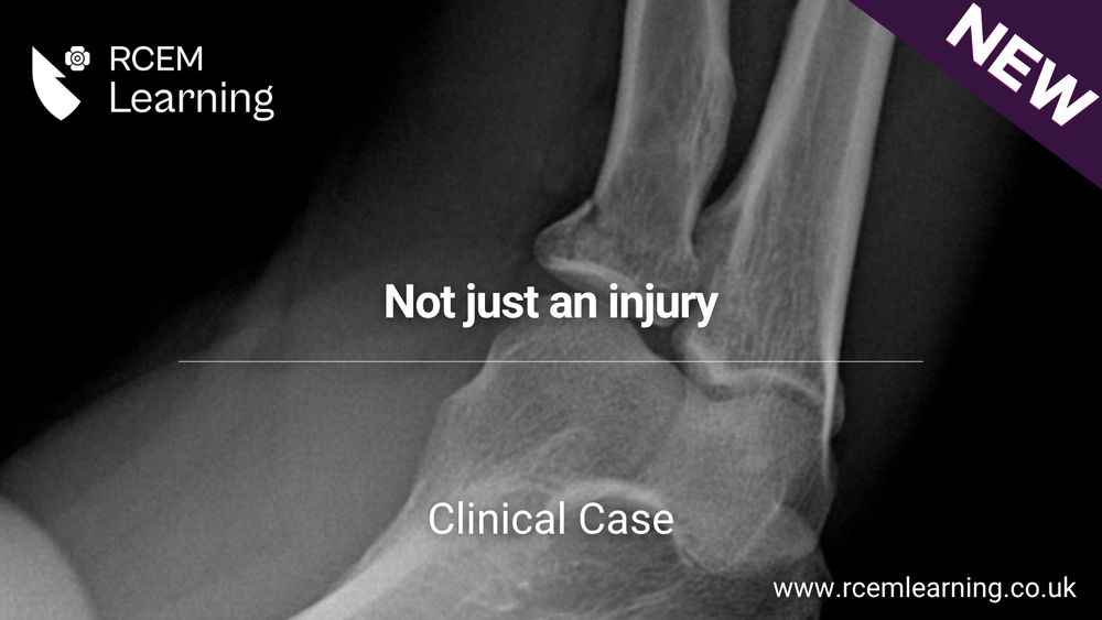 RCEMLearning logo on white. An X-Ray of an elbow. Alt Text: Not just an injury. Clinical Case.