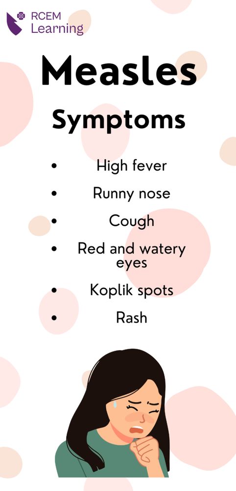 Measles - Symptoms 
High Fever, Runny nose, Cough, Red and watery eyes, Koplik Spots, Rash