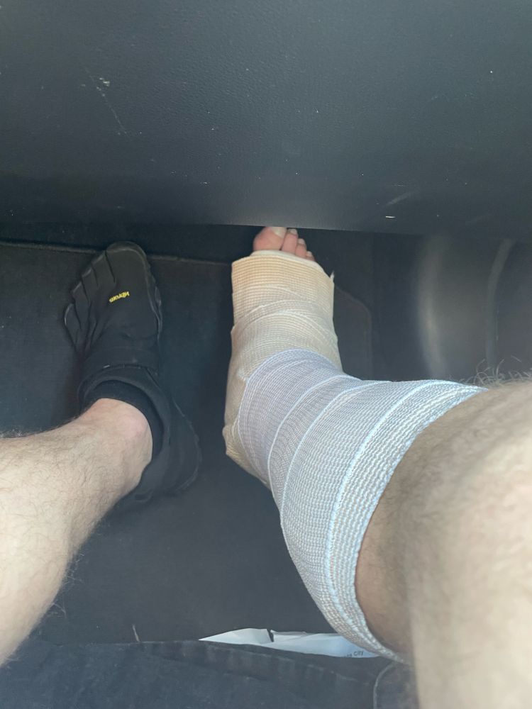 My leg and foot in a splint 