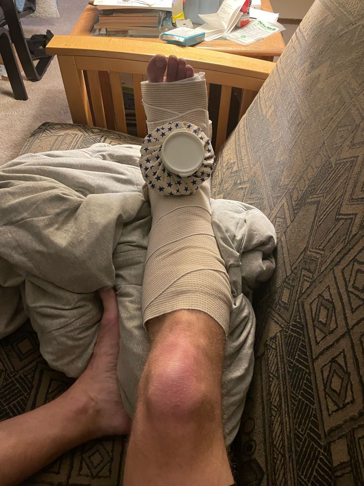 My leg in a splint and an ice pack
