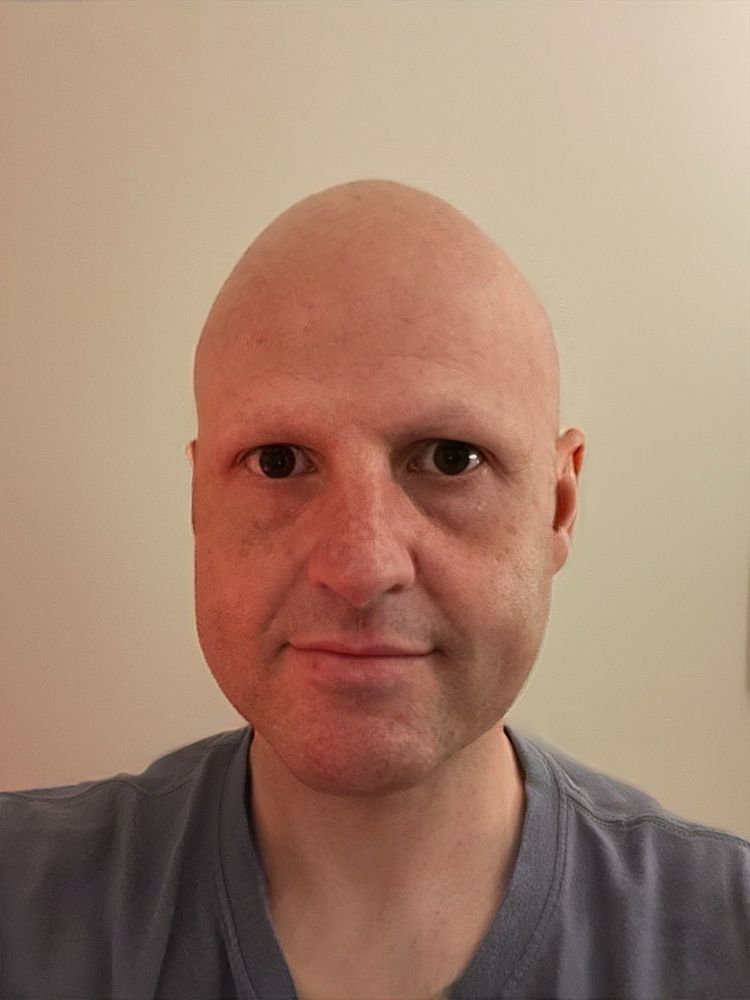 Bald Selfie