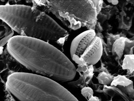 Des diatomées "photographiées" au microscope électronique