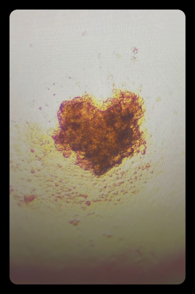 Microscopie picture of a tumor spheroid in the shape of a heart. The spheroid is brownish on a clear background. It seems partly damaged with rough edges 
