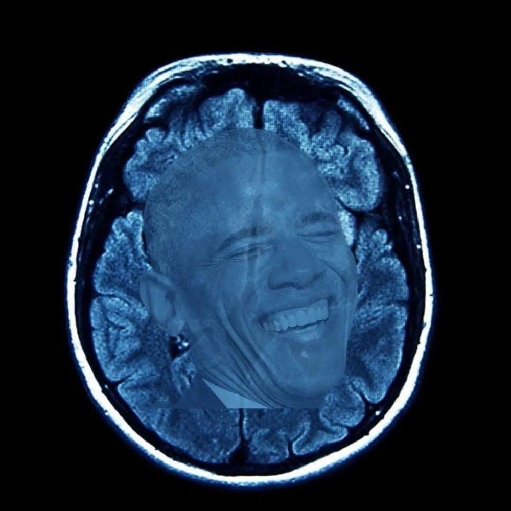 Picture of a brain, with Obama's laughing face super imposed upon it. 