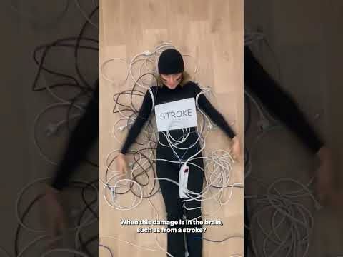 Rumble in the brain tangle