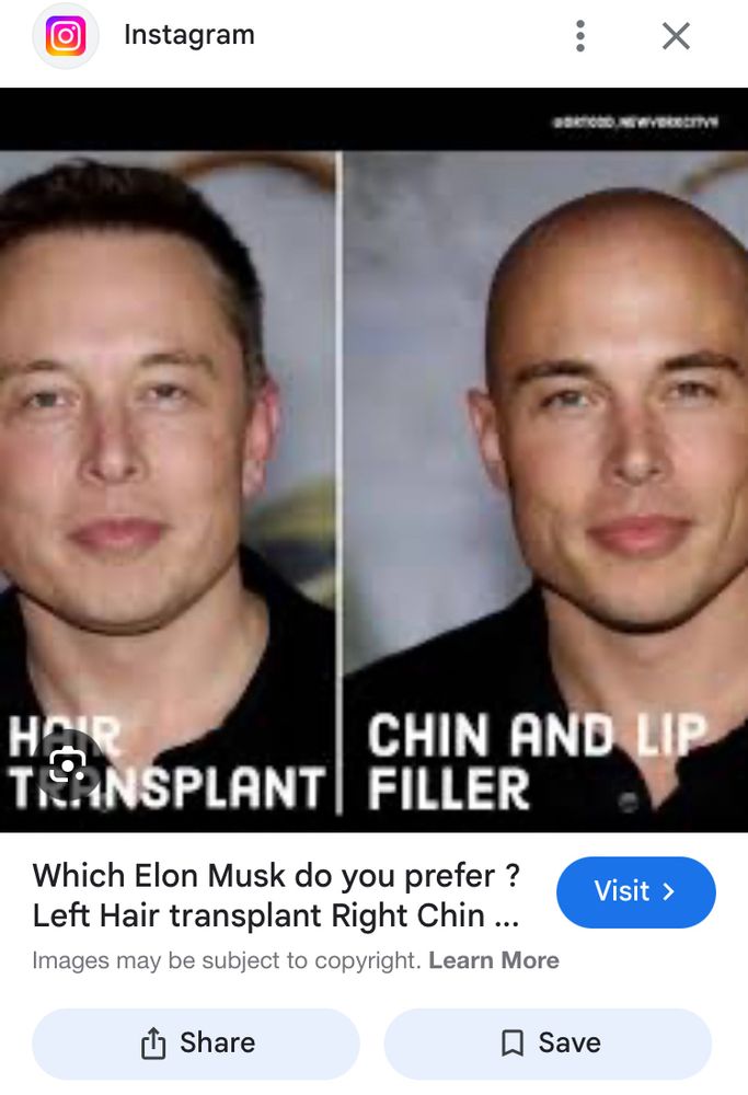 A Google image search with a photo titled “Which Elon Musk do you prefer ? Left Hair transplant Right Chin …” from Instagram with two edited versions of Elon Musk. The left half is captioned “hair transplant” with him looking relatively normal and the right is captioned “chin and lip filler,” where he looks like a slightly toned down handsome Squidward.