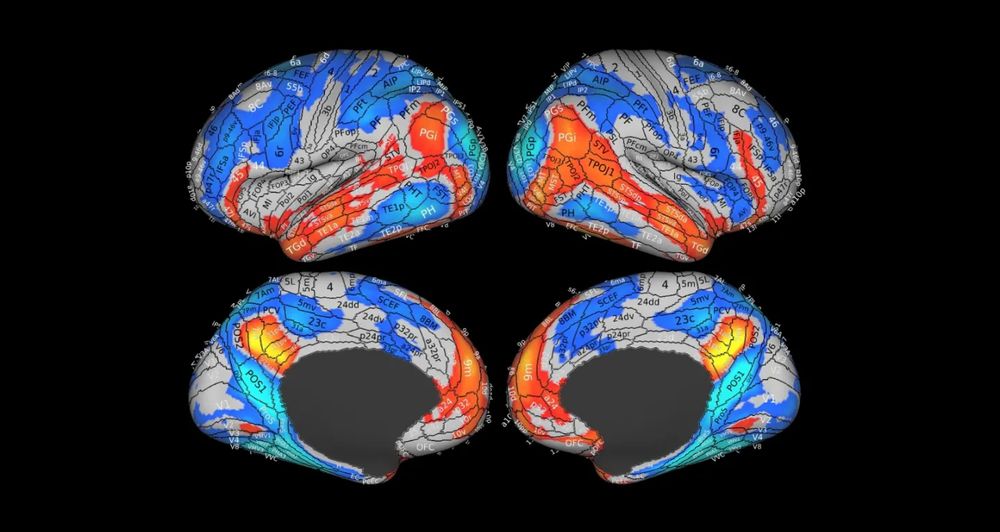 Brain scan images with some regions highlighted in reds and blues.