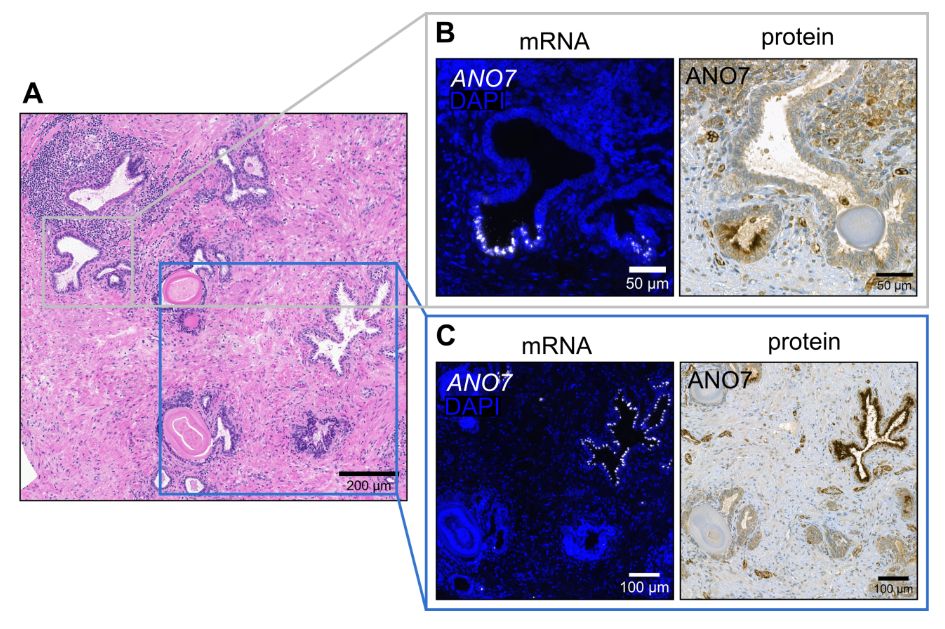 https://pathsocjournals.onlinelibrary.wiley.com/doi/epdf/10.1002/path.6405
