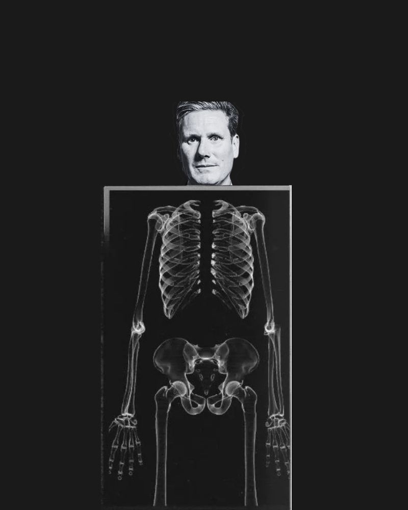 Photograph of Keir Starmer's head above an x-ray of a human skeleton, with no visible spine on a black background.