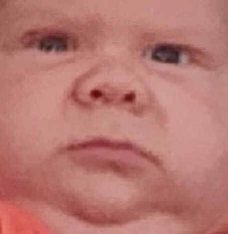A close-up of a concerned baby's face with a pronounced double chin.