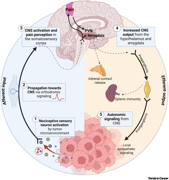 Proposed cycle between nociceptive input and autonomic output in cancer. Sensitization of nociceptive sensory neurons by the tumor microenvironment leads to propagation of orthodromic signaling towards the central nervous system (CNS). 