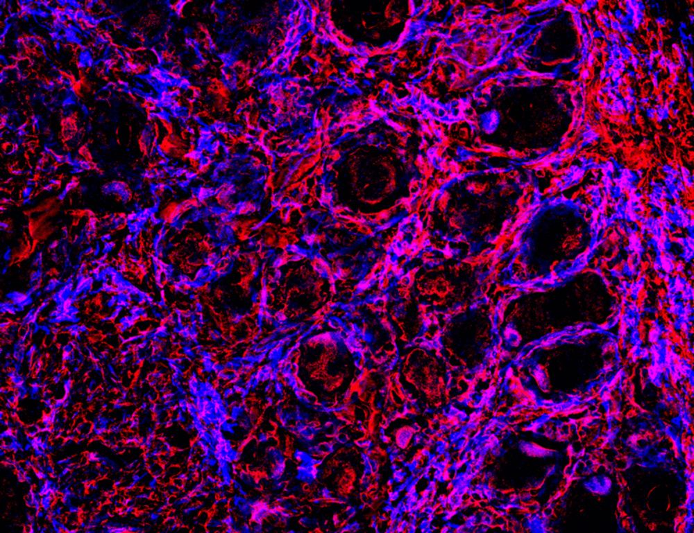 B cells drive neuropathic pain–related behaviors in mice through IgG–Fc gamma receptor signaling