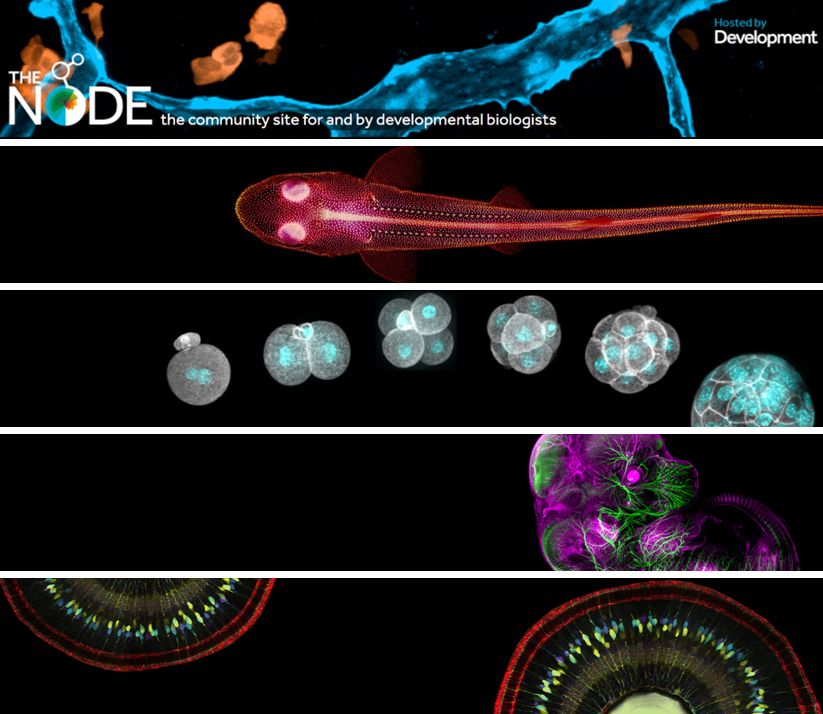Collage of the five different header images, shown from top to bottom. 

Image descriptions:
1. Zebrafish lymphatics by Daniel Castranova. Lymphatic vessels shown in blue and neutrophils shown in orange in the head of a double transgenic juvenile zebrafish.
2. Catshark by Rory Cooper. Cleared and alizarin and stained hatchling catshark embryo.
3. Preimplantation mouse embryos by Markus Schliffka. Different stages of mouse preimplantation development from the zygote to the blastocyst, with nuclei in cyan and actin in grey.
4. Zebrafish retina by Gonzalo Aparicio. Retina from a 72hpf zebrafish embryo. Photoreceptor marker shown in red, while gfap:eGFP (a Muller cell marker) is shown z-depth pseudo-coloured.
5. Mouse embryo by Evan Bardot. Cleared E12.5 embryo labelled with antibodies against Cntn2 (green) and ColIV (magenta). Generated in Collaboration with James Muller.