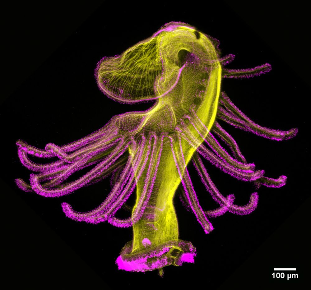 "Dancing actinotroch" by Allan Carrillo-Baltodano:
Actinotroch larva of a phoronid worm with phalloidin shown in yellow and acetylated tubulin in magenta. Imaged with a Zeiss LSM 800 at 10 x magnification.