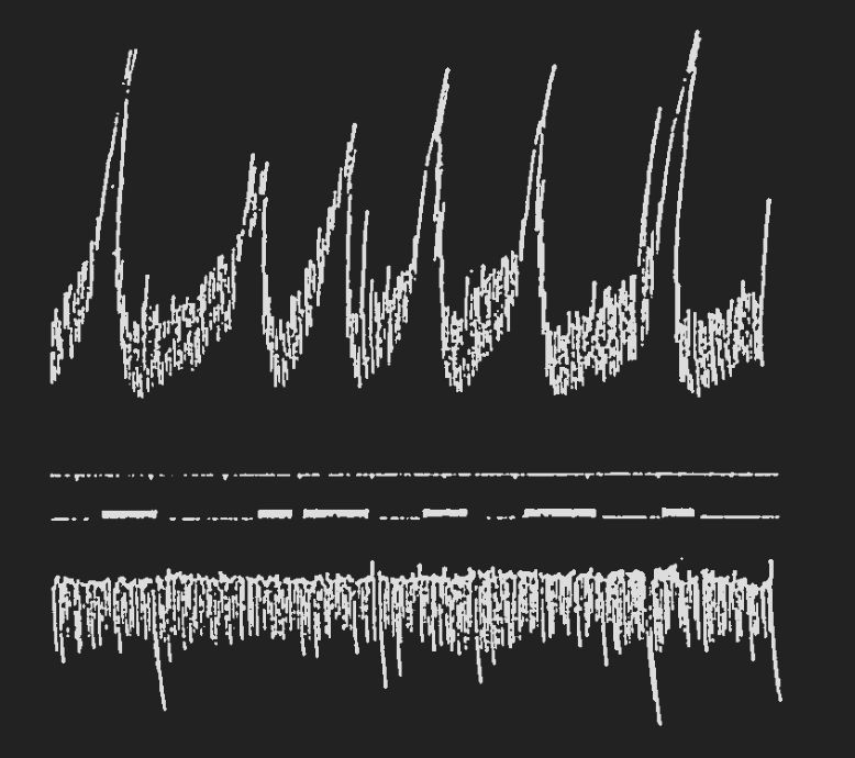 Figure 1: One half the original size. The top record represents
intragastric pressure (the small oscillations due to respiration,
the large to contractions of the stomach); the second record is
time in minutes (ten minutes); the third record is W’s report of
hunger pangs; the lowest record is respiration registered by
means of a pneumonraph about the abdomen.