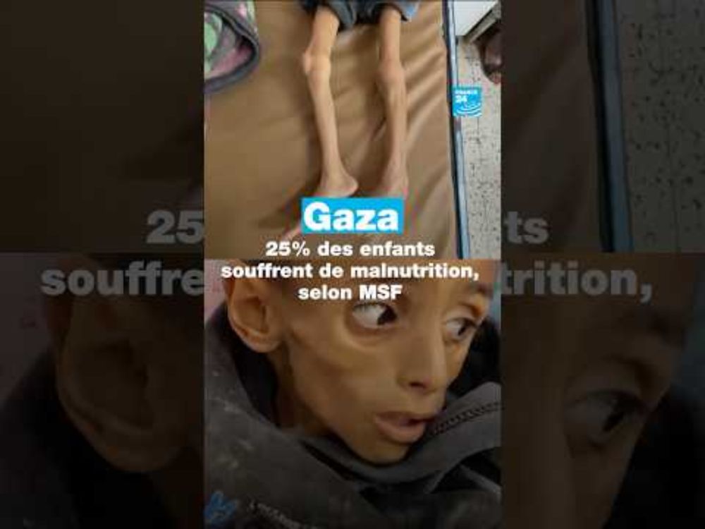 🇵🇸 #Gaza : 25% des #enfants souffrent de #malnutrition, selon MSF • FRANCE 24