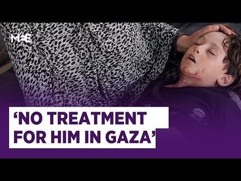 Six-year-old burned in Israeli attack on school in Gaza in need of medical treatment