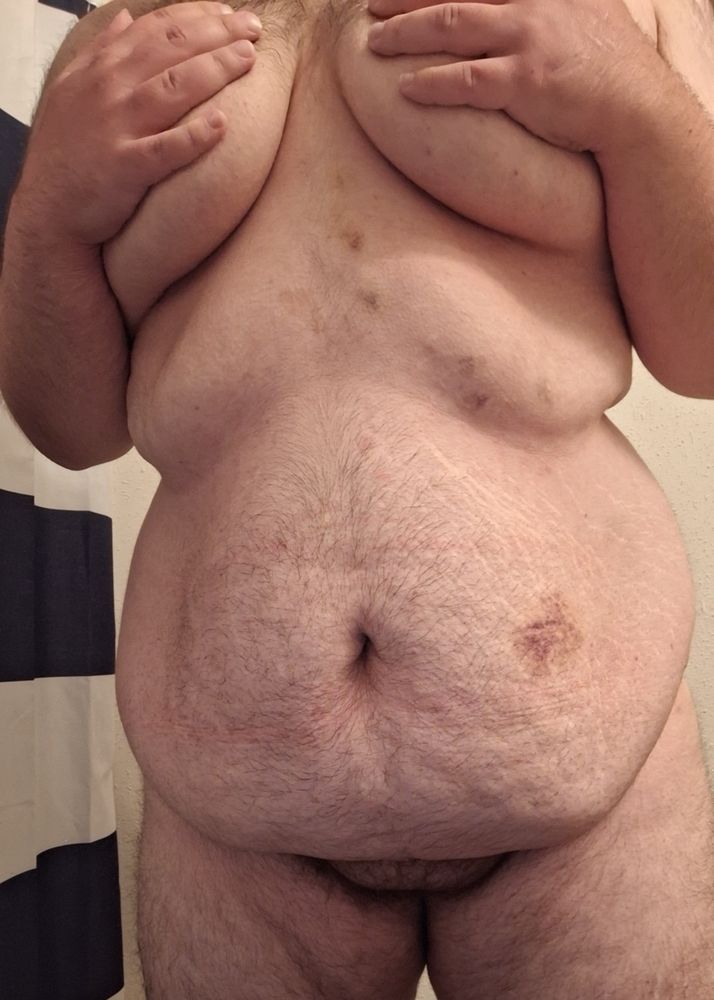 Howl stands nude in the bathroom, covering his chest with his hands and showing his belly. Fading bruises are dappled over his midsection and tummy. 