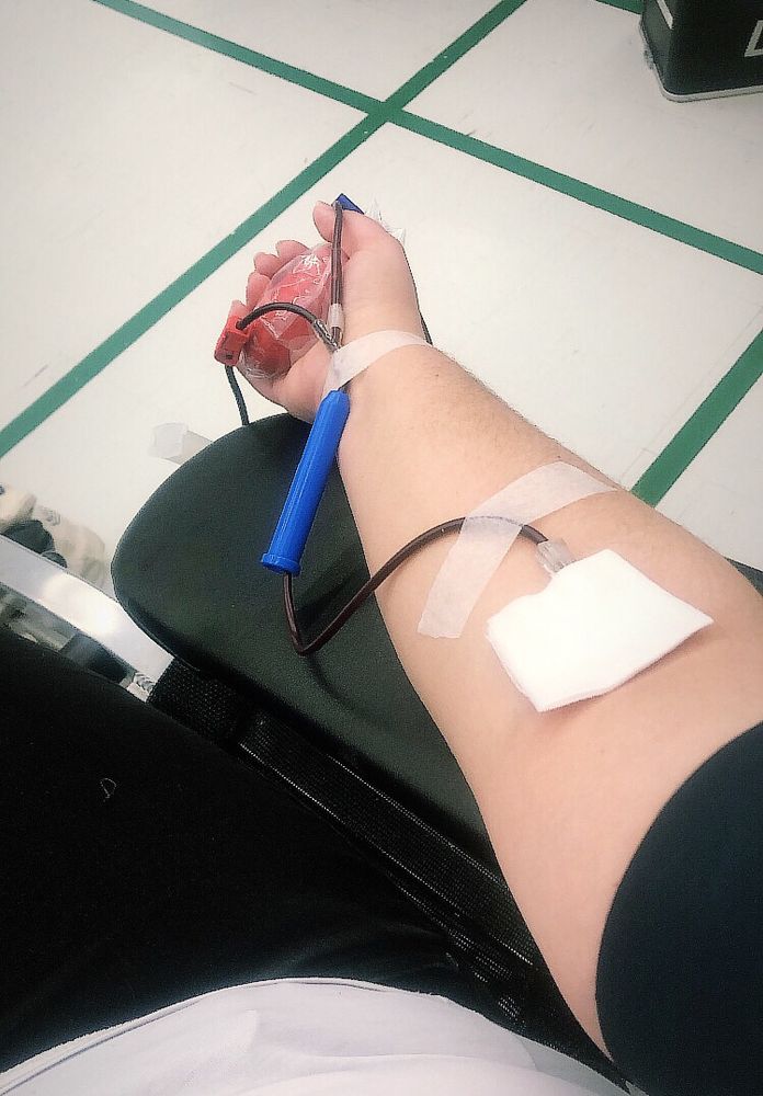 An image of an arm and an IG line with blood - the person in the photo is donating blood. 