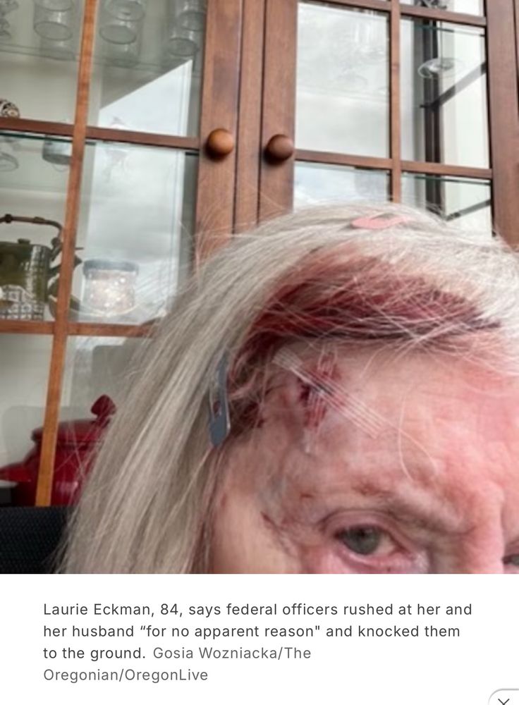 Laurie Eckman, 84, says federal officers rushed at her and her husband "for no apparent reason" and knocked them to the ground. Gosia Wozniacka/The Oregonian/OregonLive