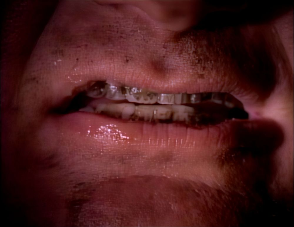 Freddy Krueger mouth closeup before he was burned.