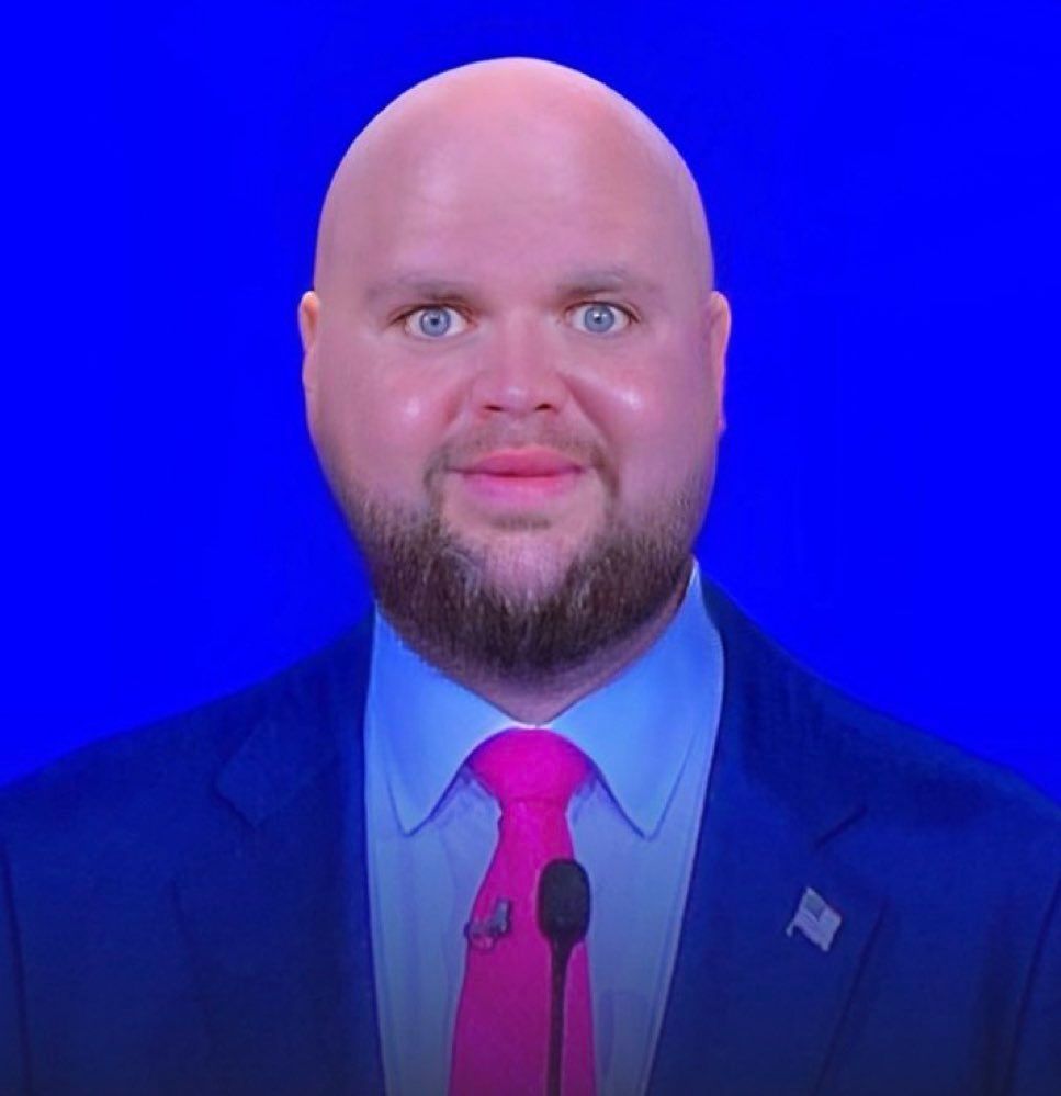 A picture of a man with a neck beard and the face of a giant ugly greasy baby