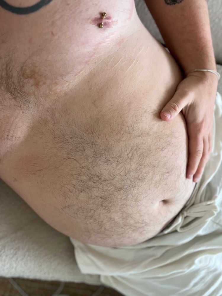 Ocean is laying with his shirt off with white shorts on. He’s holding his hairy tummy.