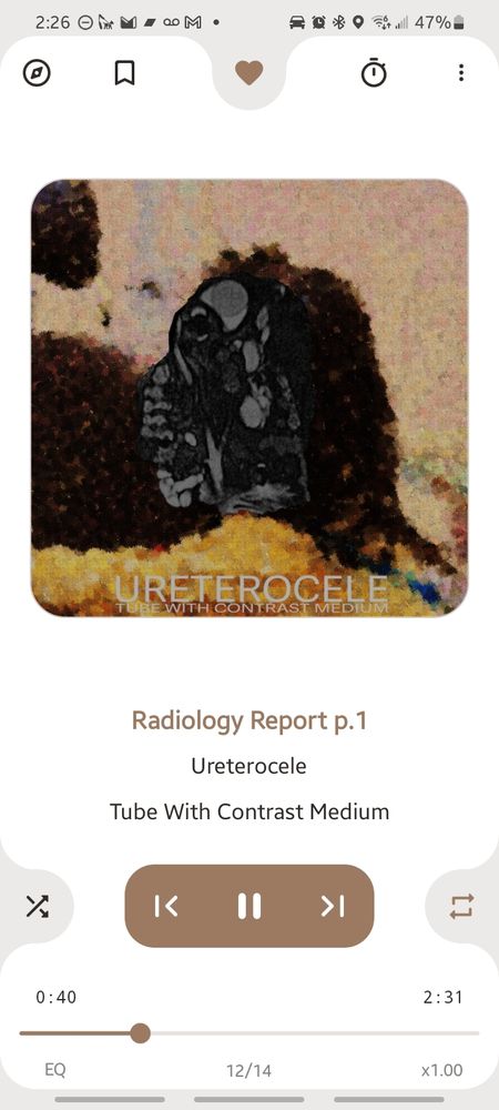 AIMP audio player screenshot showing Ureterocele's forthcoming album playing one of the final tracks titled Radiology Report Pt. 
