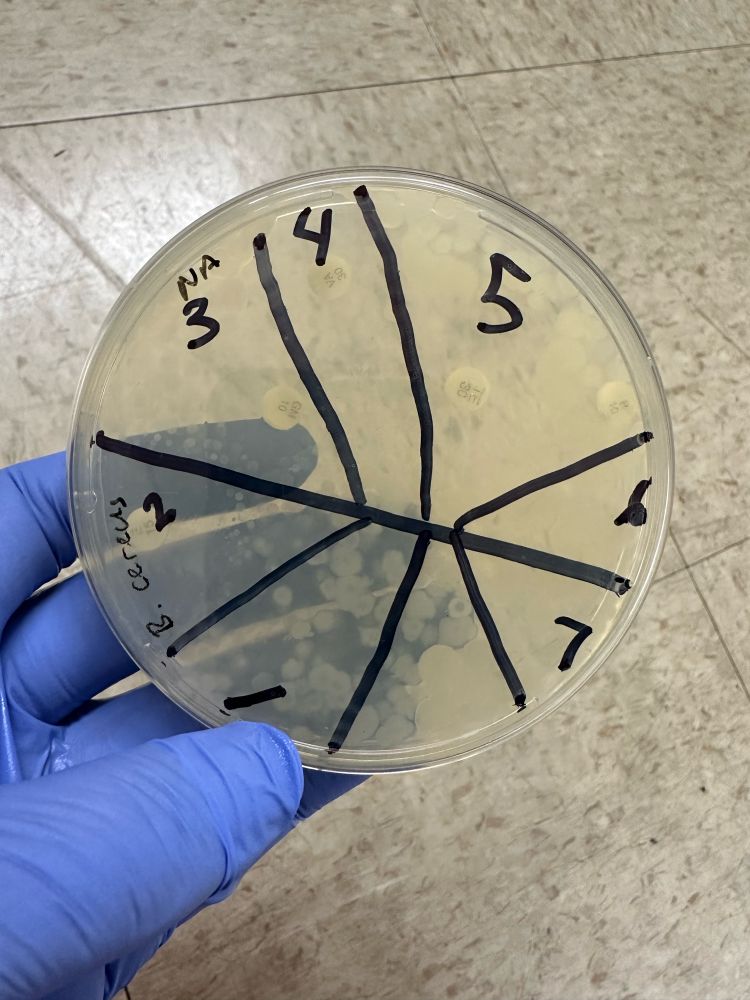 A bacterial plate held by a gloved hand. The sharpie lines should be drawn to evenly split the circle into 6 pieces, but instead the student has drawn an insect-like line and divided the circular tray into 7 different sections, each one a different shape and size. On the plate ager are antibiotic tabs and some bacterial growth.