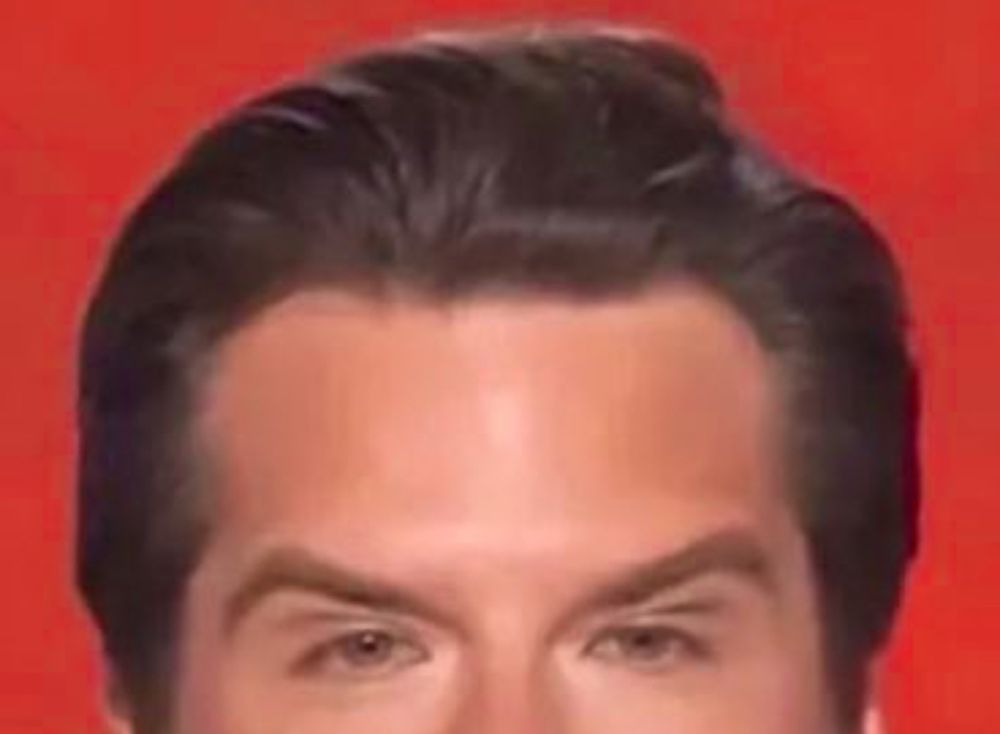 Matt Gaetz’s Botox riddled face, still surprised that he isn’t in jail already.