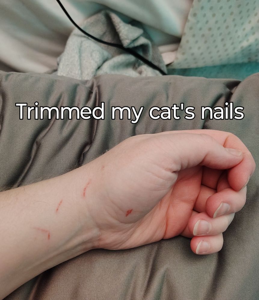 A photo of my hand with wounds all over it and text reading, "Trimmed my cat's nails"
