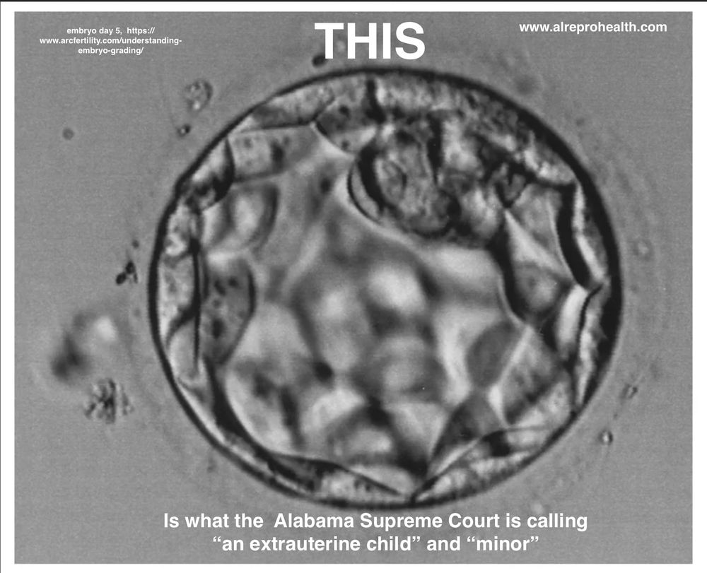 grayscale photo of round blastocyst at 5 days which looks like a weirdly scaled discoball and not a teeny weeny bitty baby. Picture reads "THIS is what the Alabama Supreme Court is calling 'an extrauterine child' and 'minor'"  Also should be noted this picture is massively blown up because we are talking head of a pin size right now.