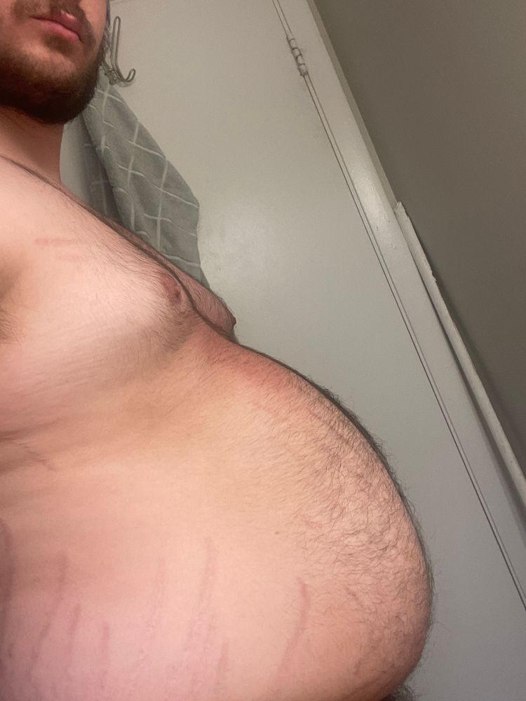 Profile of my belly, it’s hairy with faint stretch marks on the side 
