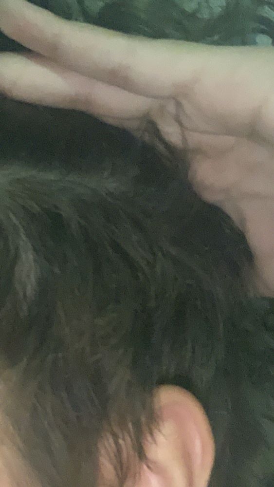 laterais crescidas pequenas