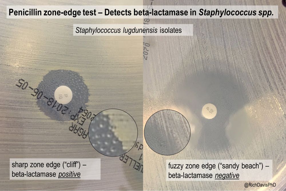 A side by side image of a bacterial growth media with white antibiotic disks and zones around them. On the left a zone with a sharp edge, onthe right a zone with a hazy, fuzzy edge

