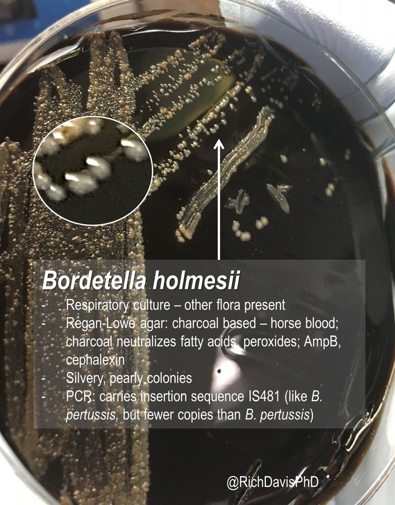 A black bacterial culture media with a lot of bacterial colonies. Caption reads, Bordetella holmesii 
Respiratory culture – other flora present
Regan-Lowe agar: charcoal based – horse blood; charcoal neutralizes fatty acids, peroxides; AmpB, cephalexin
Silvery, pearly colonies
PCR: carries insertion sequence IS481 (like B. pertussis, but fewer copies than B. pertussis)