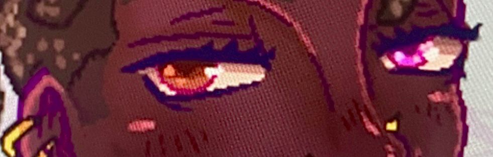 A close up of a pair of eyes on dark skin, they have Heterochromia and one of them is a hazelnut brown and the other a bright pink.