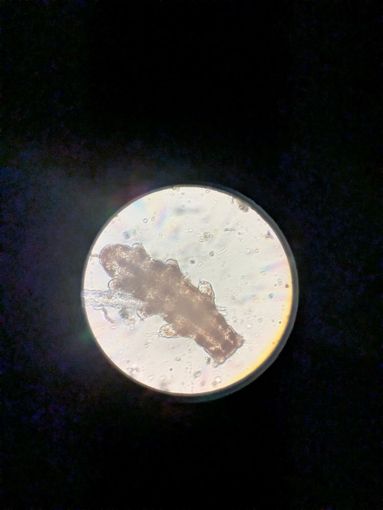 I microscope images of a tardigrade. 