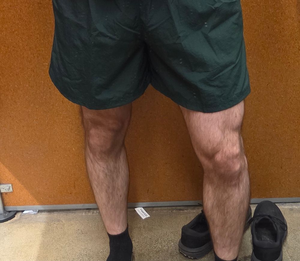 A fitting room photo of me in a pair of green shorts