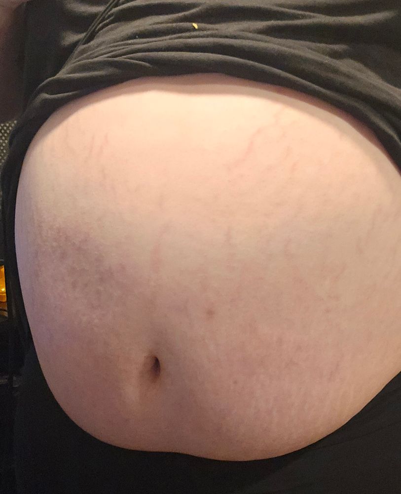 a large girls bloated belly, standing