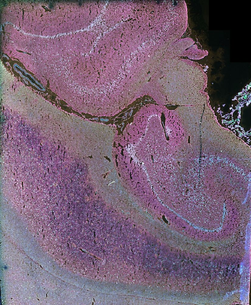 Immunolabeling for cell types in a tissue section of the human hippocampus