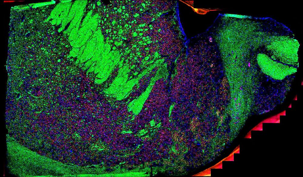 RNAscope with probes for white matter (green) and relevant cell type markers in the striatum (magenta) in tissue section of human brain at the level of the ventral striatum