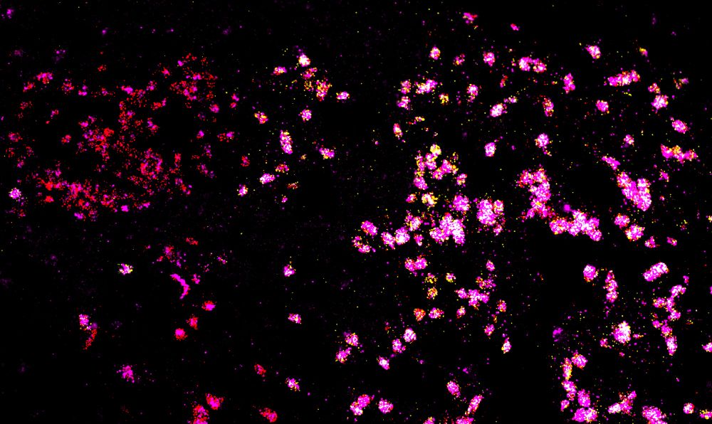 Labeling of RXFP1/DRD1/OPRM1 in tissue section of human brain through the nucleus accumbens using single molecule fluorescence in situ hybridization