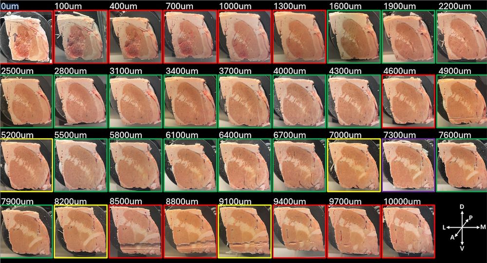 Images of face of tissue block through basal ganglia and basal forebrain levels as it is being serially sectioned